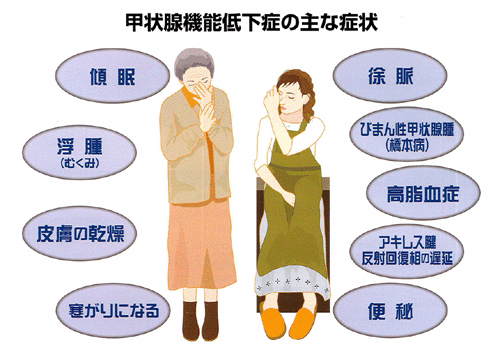 低下 甲状腺 ホルモン 甲状腺機能低下症｜一般の皆様へ｜日本内分泌学会